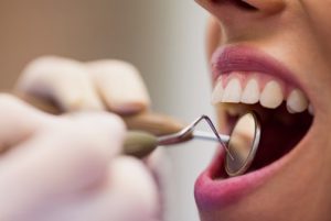 כמה באמת עולה השתלת שיניים ואיזה סוגי טיפולים יש כיום